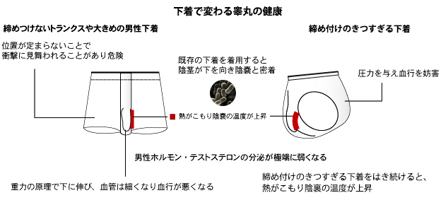 陰嚢・睾丸・キンタマの痛み、違和感、腫れ、痒み | 東京泌尿器科クリニック上野