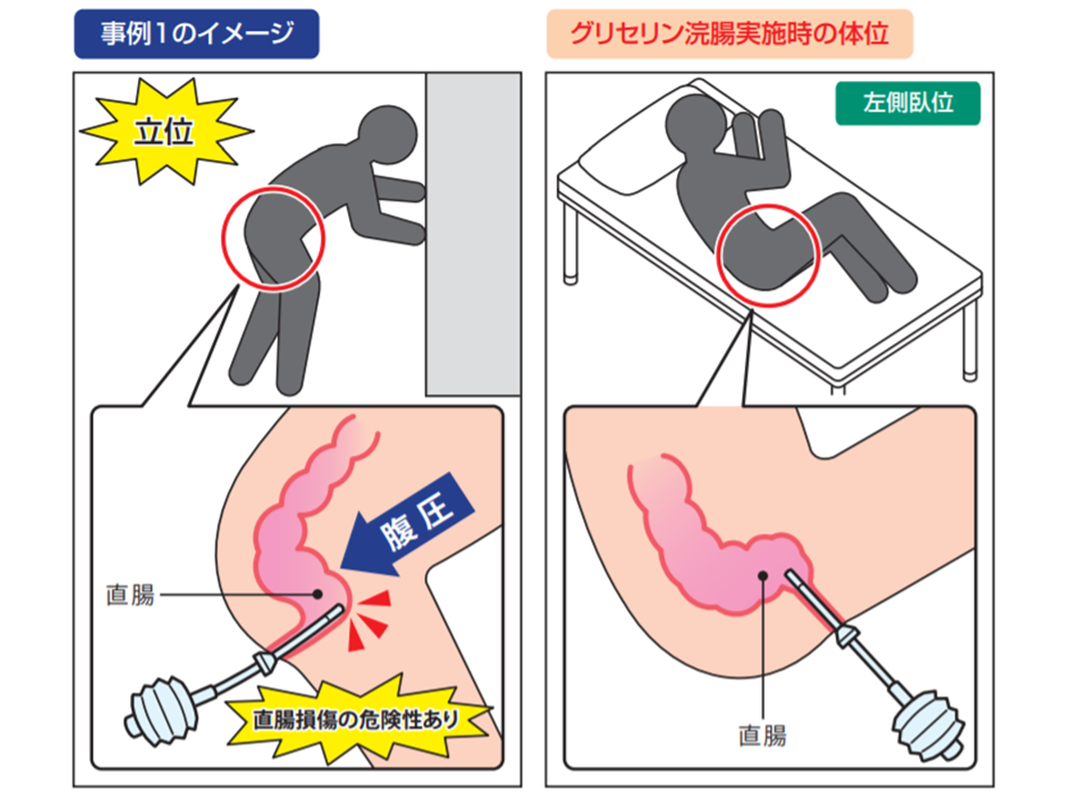 ＳＭとしての浣腸プレイ | 悪魔の性典