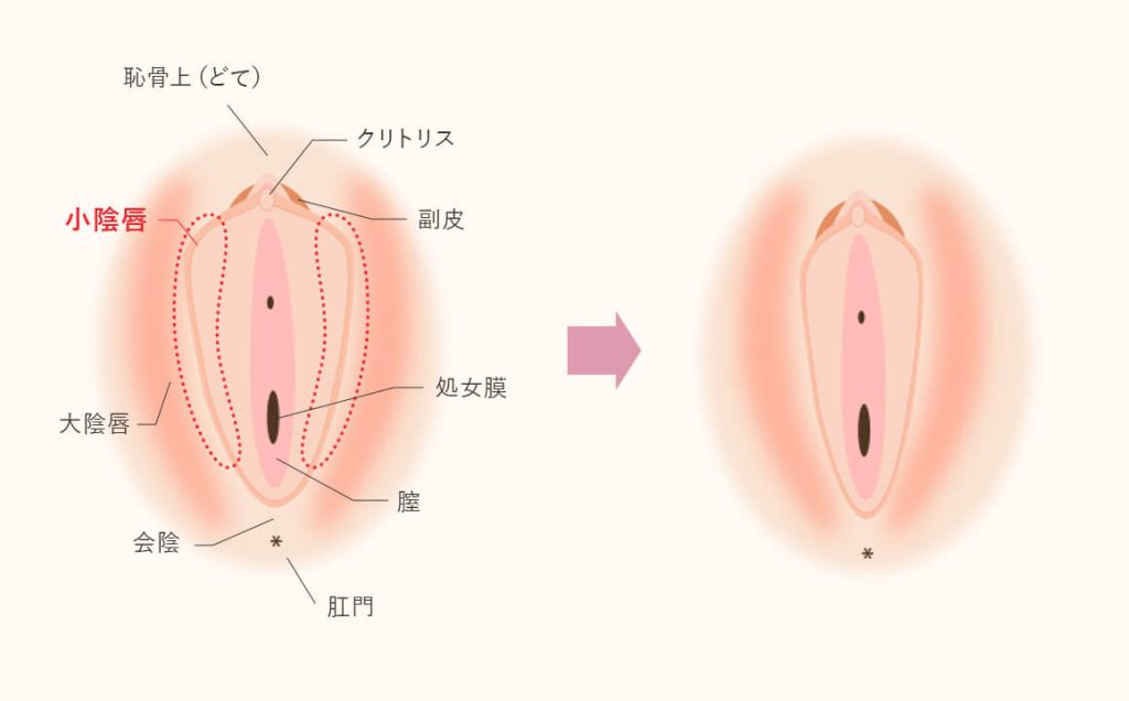 泣いても終わらない無限クリイキ配信」クリの裏側から歯ブラシでゴシゴシ！！！！ - DLチャンネル みんなで作る二次元情報サイト！