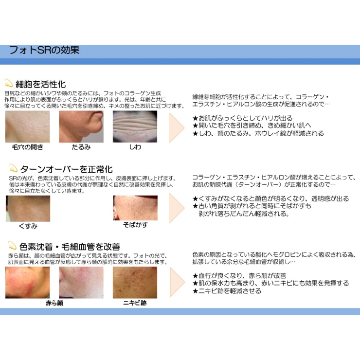 ニキビのもとから撃退！！殺菌、抗菌、鎮静でニキビ、ニキビ跡にもアプローチ | メンズ脱毛フェイシャル専門店 joieange京橋(メンズダツモウフェイシャルセンモン