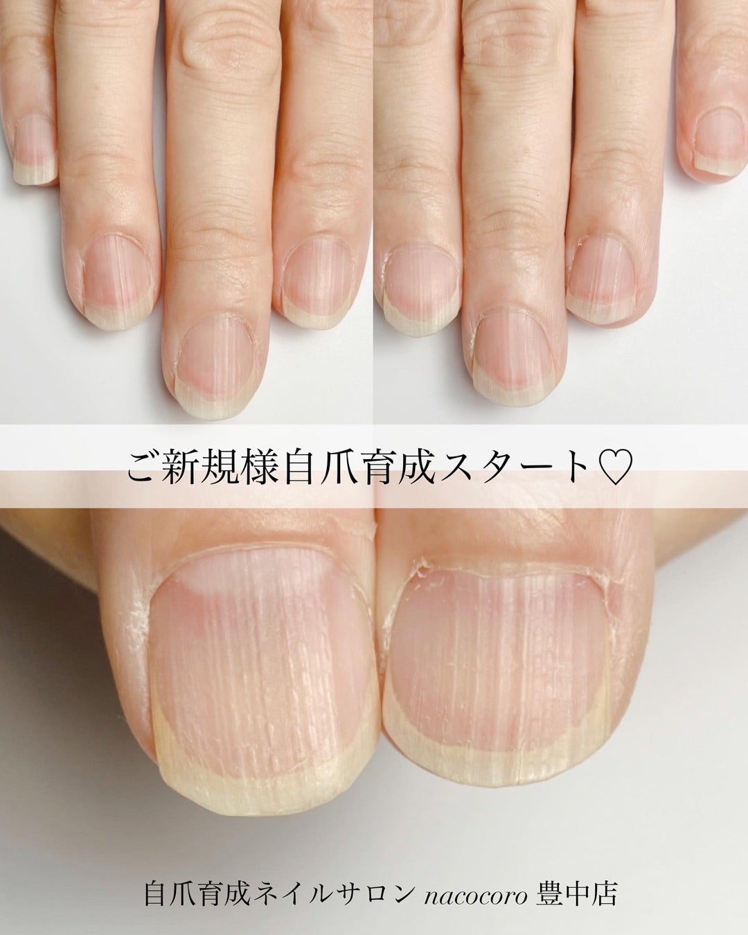 nico nail |