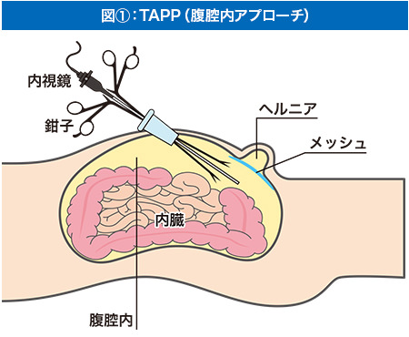 オルゴン療法-うつなどの精神的疾患症状に | オルゴン療法とは |