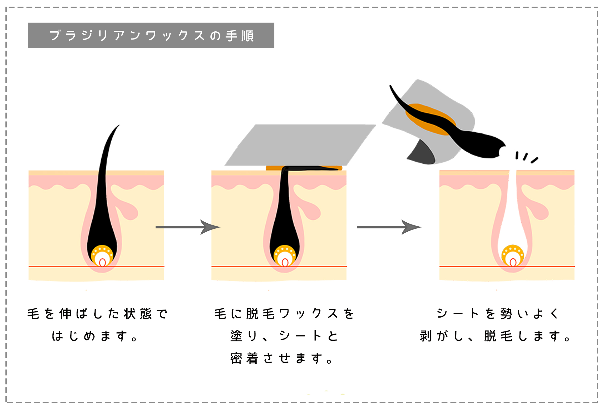 Amazon.co.jp: ワックスウォーマー ワックスキット 脱毛ワックス 無痛家庭用ワックス脱毛セット、顔、眉毛、脇の下、脚、ビキニ女性男性無痛