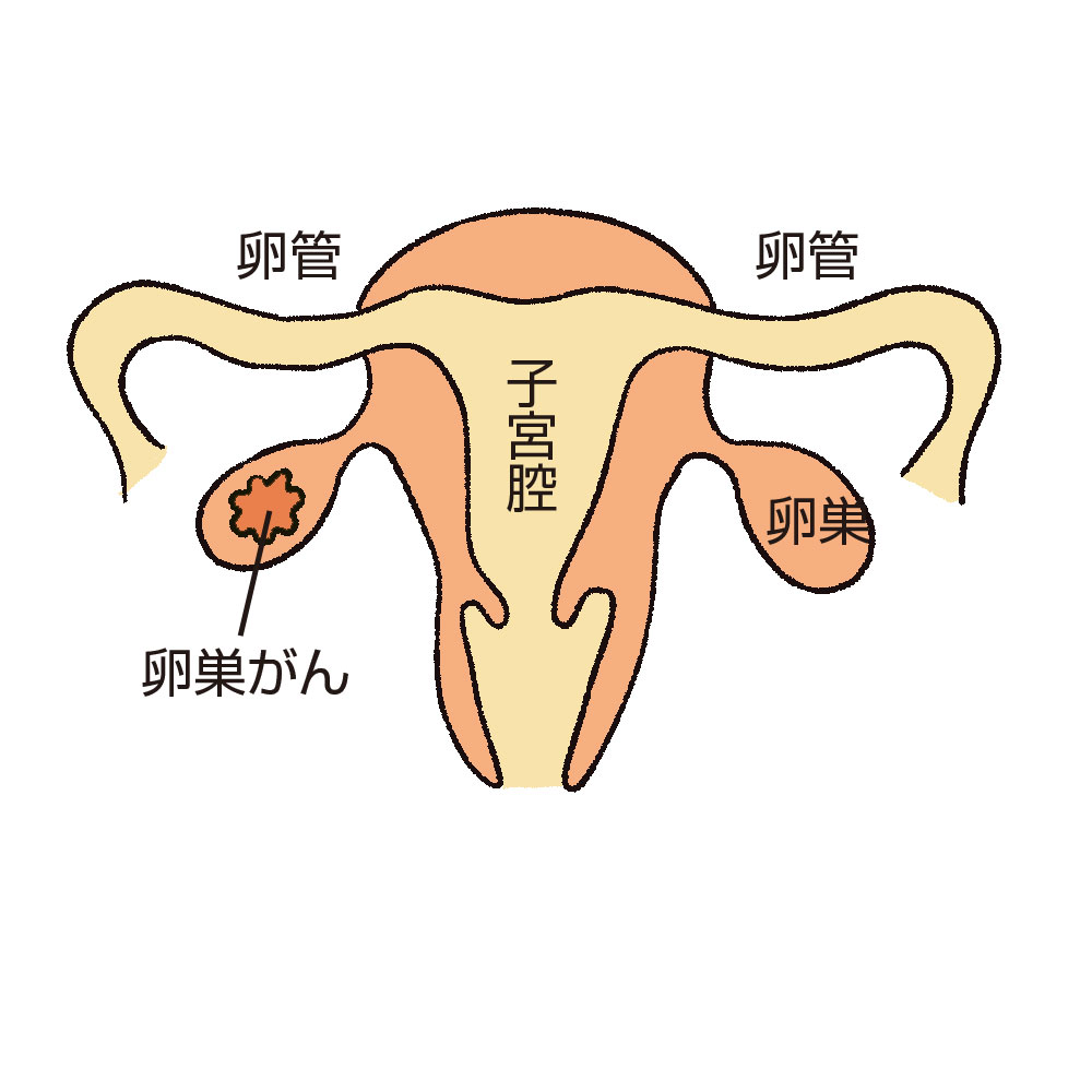 子宮体がん（子宮内膜がん） 全ページ：[国立がん研究センター がん情報サービス 一般の方へ]